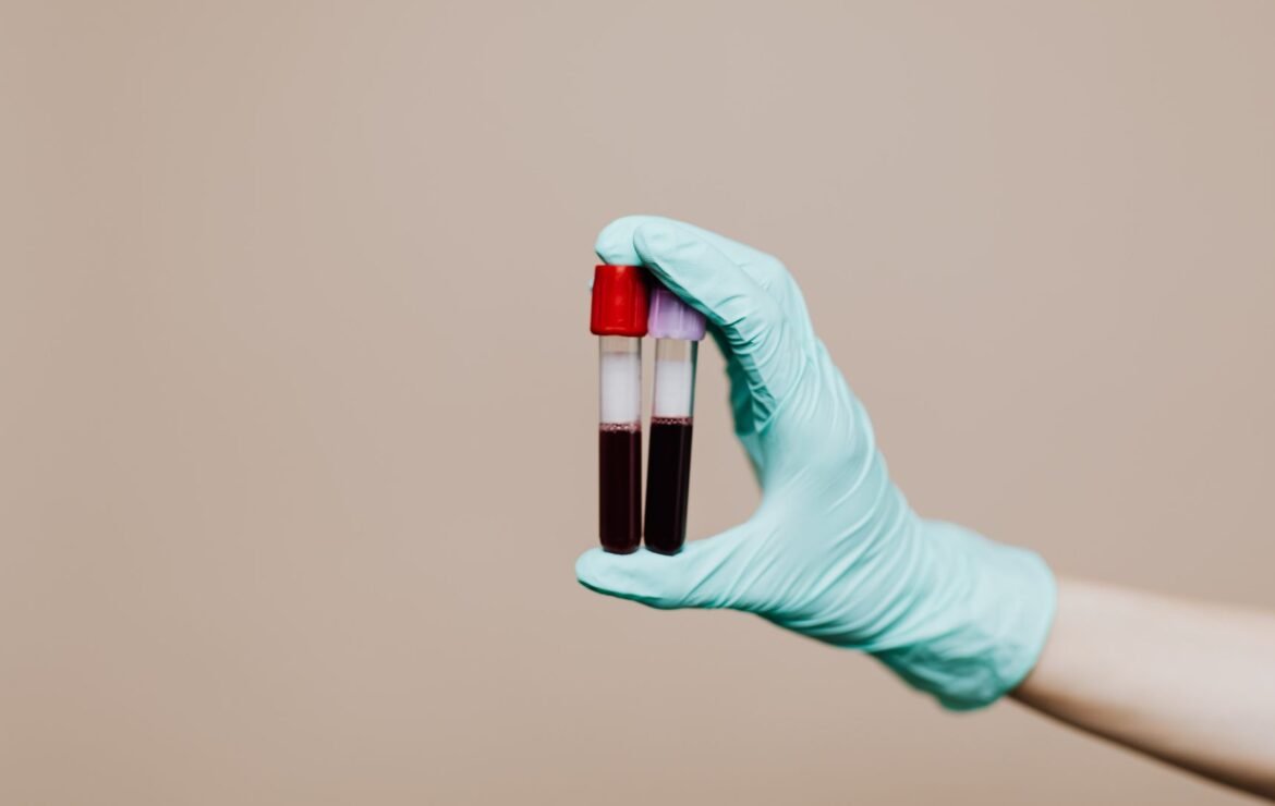 Ferro e ferritina: o que esses exames avaliam?