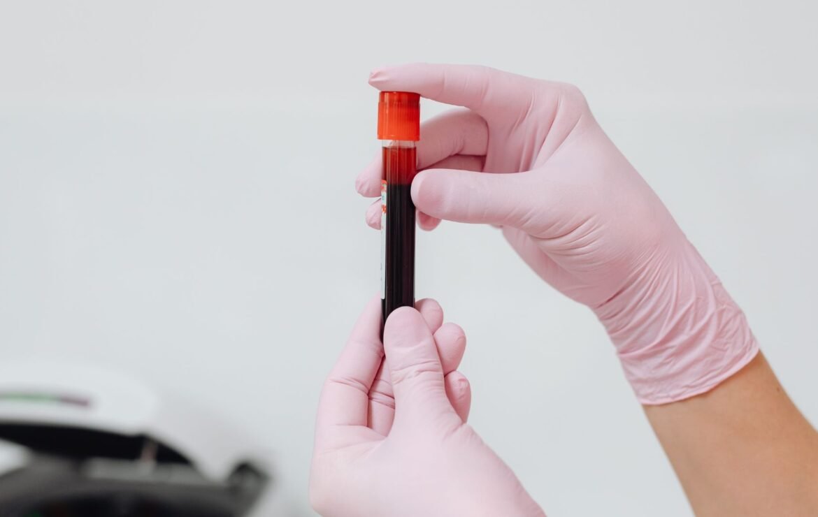 Marcadores tumorais: qual o papel na detecção precoce do câncer?