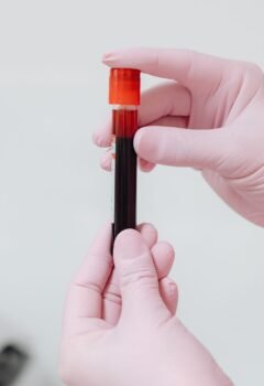 Marcadores tumorais: qual o papel na detecção precoce do câncer?